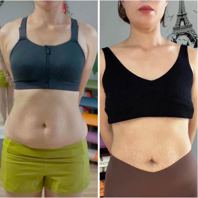 Ảnh chụp chính diện trước và sau 28 ngày Reset28 của học viên